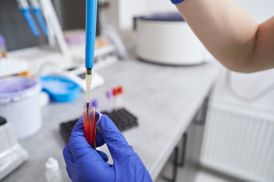 A gloved hand holds a test tube from which material is taken for examination