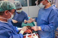 The First Simultaneous Heart-Liver Transplantation in Poland 